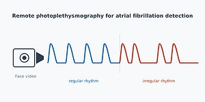 Survey on contactless atrial fibrillation detection accepted in IEEE Access